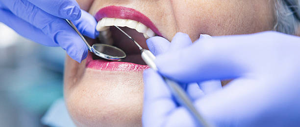 Fast & Reliable Emergency Dental Services in IA